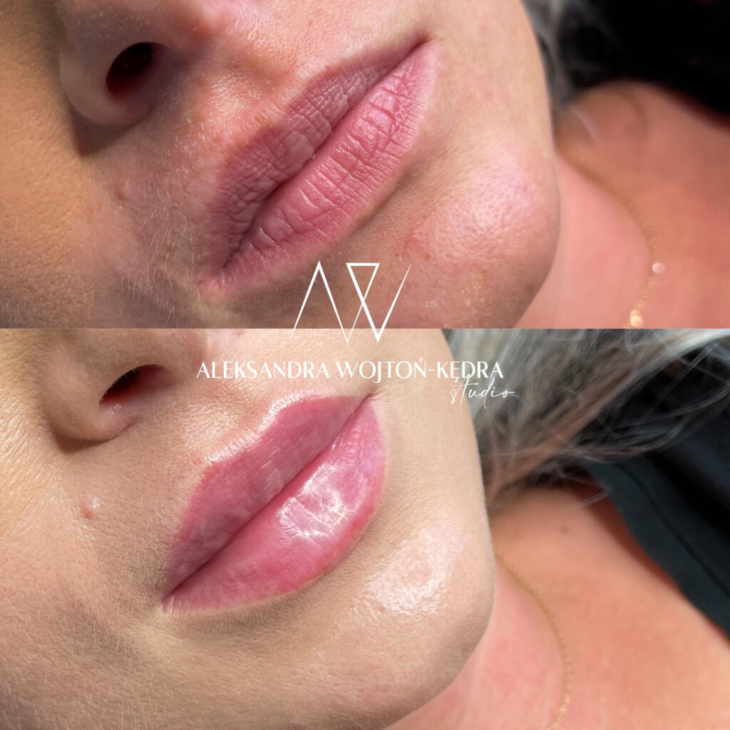 modelowanie ust kraków joanna komenda beauty concept aleksandra wojtoń kędra kosmetolog