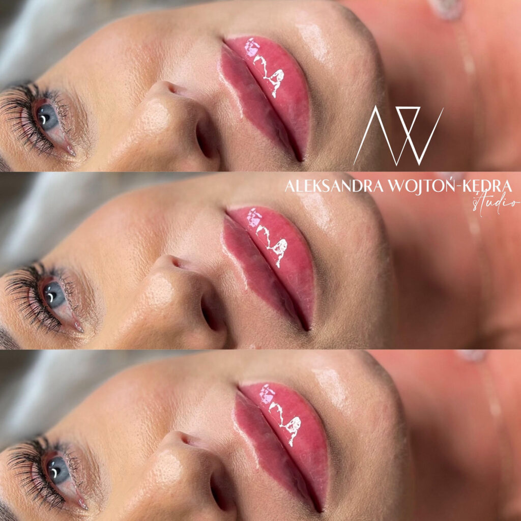 modelowanie ust kraków joanna komenda beauty concept aleksandra wojtoń kędra kosmetolog
